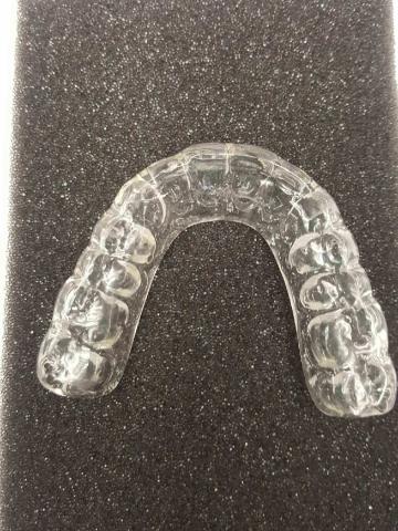 Occlusal guard