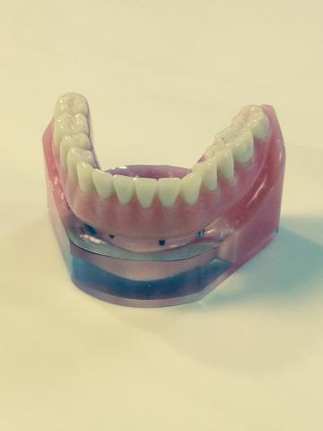 Image of Denture